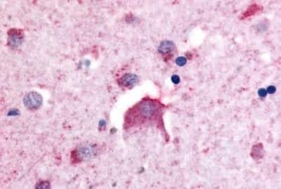 Immunohistochemistry-Paraffin: DPP6 Antibody [NBP3-14301] - Immunohistochemistry of formalin-fixed, paraffin-embedded human brain, neurons, after heat-induced antigen retrieval.